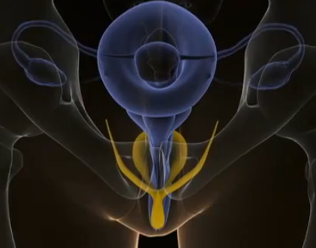 MRI clitoris top view. Image from http://blog.museumofsex.com/the-internal-clitoris/
